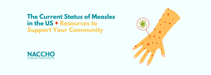 2026 Measles Blog 700x250