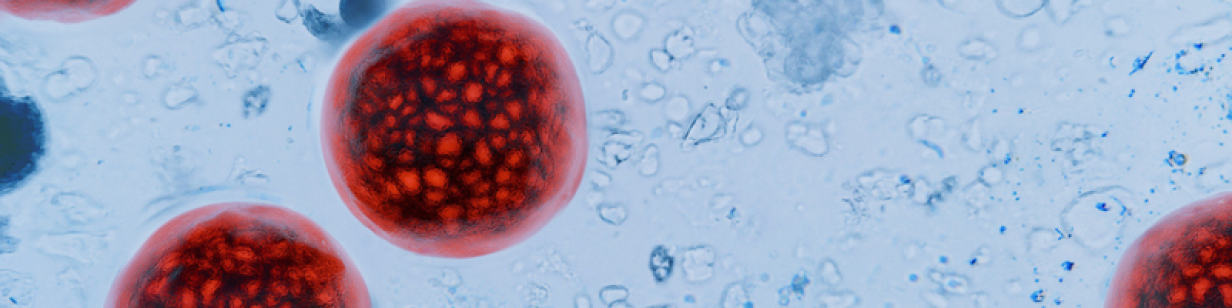 Cyclospora card