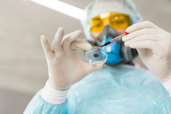 Outbreak testing lab scientist ci