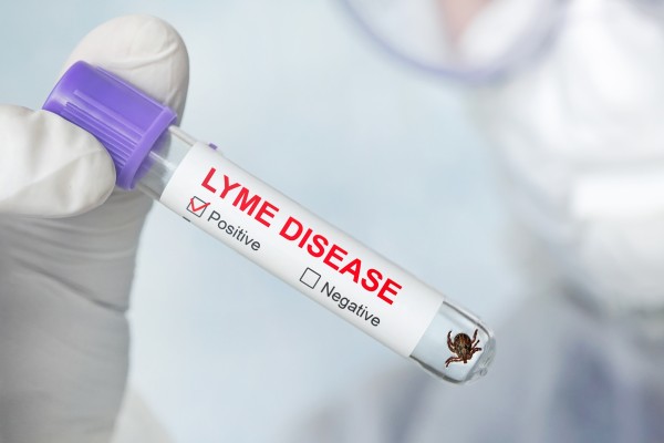 Lyme disease label on a test tube with tick inside i Stock 1223178635